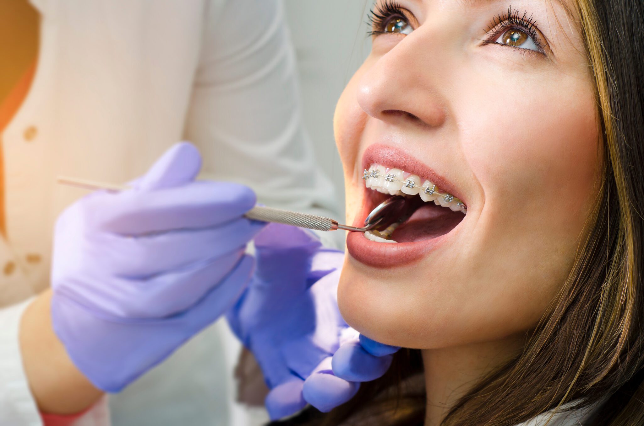 Types of Braces